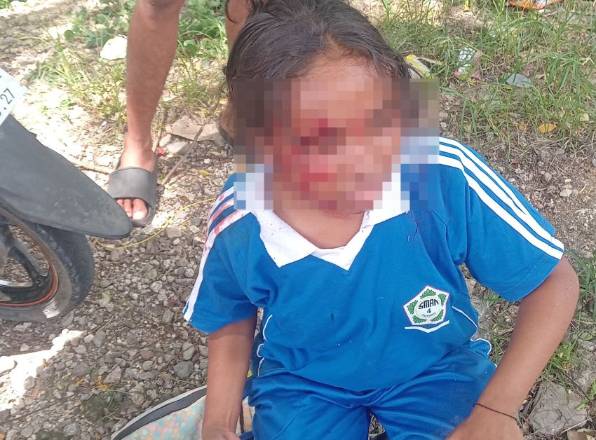 Begal Beraksi di Siang Hari, Siswi SMA Negeri 4 Kupang Jadi Korban